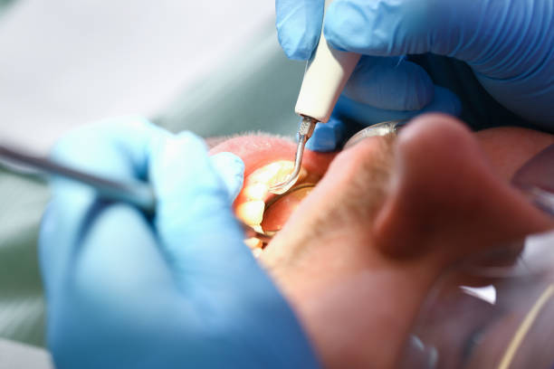 Best Emergency Gum Treatment in Hoxie, AR